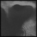 Meddle